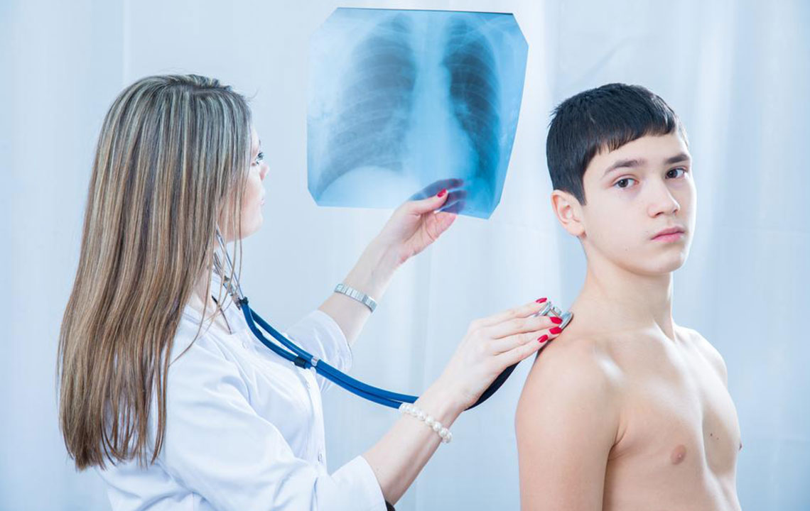 Pneumococcal Pneumonia – Symptoms, Treatment, and More